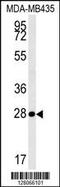 Mitochondrial RRNA Methyltransferase 1 antibody, 55-156, ProSci, Western Blot image 