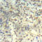 Cofilin 1 antibody, AP0330, ABclonal Technology, Immunohistochemistry paraffin image 