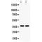 Aryl Hydrocarbon Receptor antibody, LS-C407634, Lifespan Biosciences, Western Blot image 