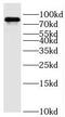 Oxysterol Binding Protein Like 11 antibody, FNab06018, FineTest, Western Blot image 