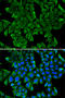 Regenerating Family Member 3 Gamma antibody, STJ25328, St John