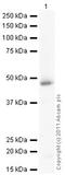 Matrix Metallopeptidase 3 antibody, ab18898, Abcam, Western Blot image 
