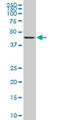 Gasdermin B antibody, LS-C139466, Lifespan Biosciences, Western Blot image 