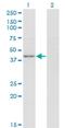 Protein Phosphatase 1 Regulatory Subunit 8 antibody, H00005511-M05, Novus Biologicals, Western Blot image 