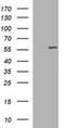 Tubulin Alpha 1c antibody, NBP2-46244, Novus Biologicals, Western Blot image 