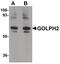 Golgi Membrane Protein 1 antibody, PA5-20837, Invitrogen Antibodies, Western Blot image 