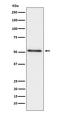 Acid Phosphatase, Prostate antibody, M02082-1, Boster Biological Technology, Western Blot image 