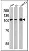 Heat Shock Protein 90 Beta Family Member 1 antibody, GTX22791, GeneTex, Western Blot image 