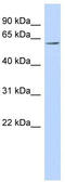 Transmembrane Protein 209 antibody, TA344236, Origene, Western Blot image 