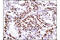 Minichromosome Maintenance Complex Component 2 antibody, 12079S, Cell Signaling Technology, Immunohistochemistry paraffin image 