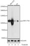 Eukaryotic Translation Elongation Factor 2 antibody, A00830T56, Boster Biological Technology, Western Blot image 