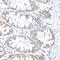 Hydroxysteroid 17-Beta Dehydrogenase 10 antibody, 19-669, ProSci, Immunohistochemistry paraffin image 