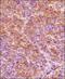 HIF1-alpha antibody, NB100-654, Novus Biologicals, Immunohistochemistry paraffin image 