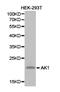 Adenylate Kinase 1 antibody, TA327004, Origene, Western Blot image 