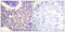 Arrestin Beta 1 antibody, LS-C198643, Lifespan Biosciences, Immunohistochemistry frozen image 