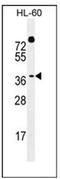 Double homeobox protein 4 antibody, AP51342PU-N, Origene, Western Blot image 