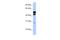 KLC2 antibody, A09860, Boster Biological Technology, Western Blot image 