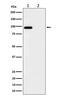 Fibroblast Growth Factor Receptor 3 antibody, P00200, Boster Biological Technology, Western Blot image 