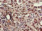 Caspase 6 antibody, CSB-PA004551EA01HU, Cusabio, Immunohistochemistry paraffin image 