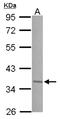 JunD Proto-Oncogene, AP-1 Transcription Factor Subunit antibody, NBP2-17010, Novus Biologicals, Western Blot image 