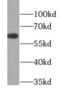Keratin 6B antibody, FNab04656, FineTest, Western Blot image 