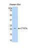 Interleukin 12 Receptor Subunit Beta 2 antibody, LS-C299860, Lifespan Biosciences, Western Blot image 