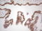 RB Transcriptional Corepressor 1 antibody, LS-C790686, Lifespan Biosciences, Immunohistochemistry paraffin image 