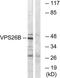 VPS26, Retromer Complex Component B antibody, TA316005, Origene, Western Blot image 