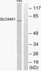 Solute Carrier Family 44 Member 1 antibody, PA5-39606, Invitrogen Antibodies, Western Blot image 