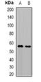 TRNA Methyltransferase 61B antibody, orb341429, Biorbyt, Western Blot image 