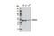 Protein Tyrosine Phosphatase Non-Receptor Type 18 antibody, 8311S, Cell Signaling Technology, Western Blot image 