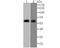 PARP2 antibody, A03270, Boster Biological Technology, Western Blot image 