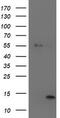 Leukocyte Cell Derived Chemotaxin 2 antibody, TA504091S, Origene, Western Blot image 