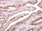 Golgi Membrane Protein 1 antibody, GTX107702, GeneTex, Immunohistochemistry paraffin image 