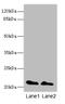 KRAS Proto-Oncogene, GTPase antibody, A52273-100, Epigentek, Western Blot image 