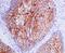 C-X-C Motif Chemokine Receptor 4 antibody, M00031, Boster Biological Technology, Immunohistochemistry paraffin image 