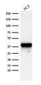 Alpha-Methylacyl-CoA Racemase antibody, GTX34410, GeneTex, Western Blot image 