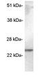 Secretory Carrier Membrane Protein 5 antibody, GTX23432, GeneTex, Western Blot image 