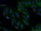 Decapping MRNA 1B antibody, 13863-1-AP, Proteintech Group, Immunofluorescence image 