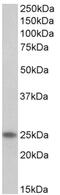 Troponin I1, Slow Skeletal Type antibody, AP32709PU-N, Origene, Western Blot image 