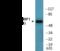 Heat Shock Transcription Factor 1 antibody, EKC2552, Boster Biological Technology, Western Blot image 