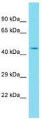 Trafficking Protein Particle Complex 13 antibody, TA330760, Origene, Western Blot image 