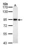 M3K20 antibody, NBP1-33137, Novus Biologicals, Western Blot image 