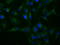 Hexose-6-Phosphate Dehydrogenase/Glucose 1-Dehydrogenase antibody, GTX84394, GeneTex, Immunofluorescence image 