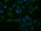 GDH antibody, GTX84394, GeneTex, Immunofluorescence image 