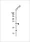 Epiregulin antibody, 61-668, ProSci, Western Blot image 