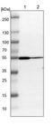 Rho GTPase Activating Protein 1 antibody, NBP1-85725, Novus Biologicals, Western Blot image 