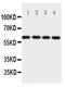 TNF Receptor Superfamily Member 11b antibody, PA5-80146, Invitrogen Antibodies, Western Blot image 
