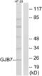 Gap Junction Protein Beta 7 antibody, abx014491, Abbexa, Western Blot image 