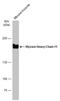 Myosin Heavy Chain 11 antibody, GTX131414, GeneTex, Western Blot image 